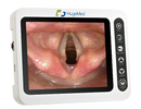 HugeMed Disposable Video Laryngoscope (VLDM)