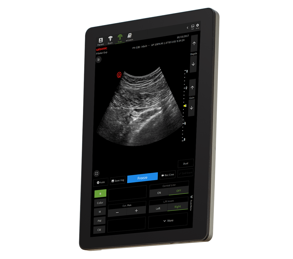 Wisonic Piloter Vet Smart Tablet Ultrasound System