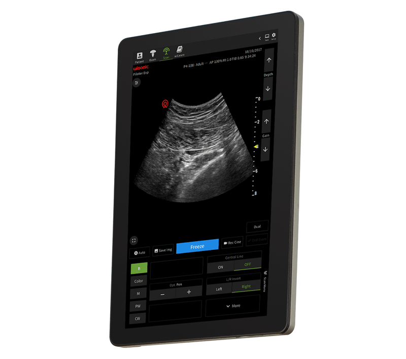 Wisonic Piloter Vet  Smart Tablet Ultrasound System