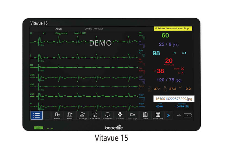 Betterlife VITAVUE 15 Multi Parameter Patient Monitor