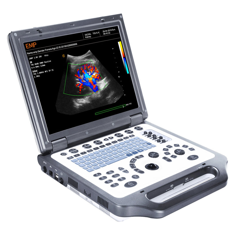 EMP G30 PORTABLE COLOR DOPPLER DIAGNOSTIC ULTRASOUND SYSTEM WITH LINEAR PROBE