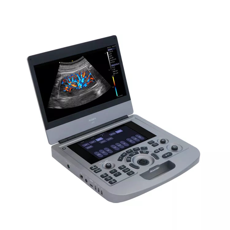 Edan AX3 Vet Portable Vet Veterinary Ultrasound Color Doppler