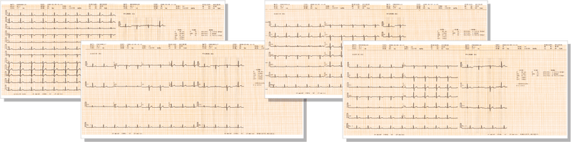 COMEN CM1200B 12-channel ECG machine