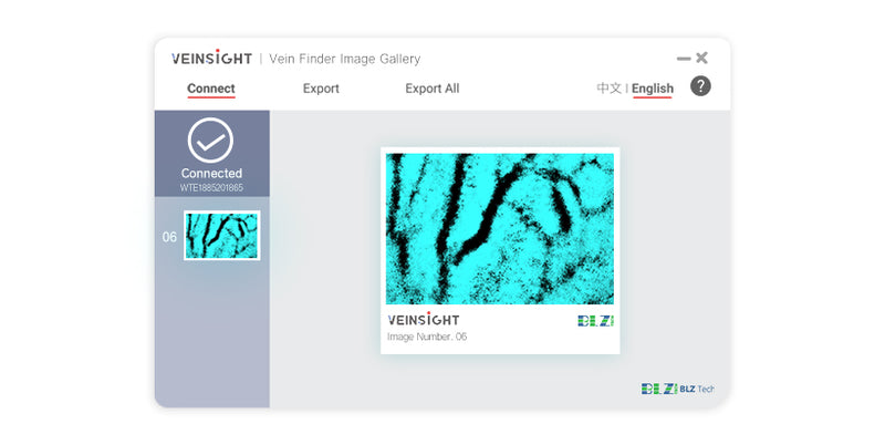 VeinSight Vein Finder VS500 - Most advanced vein finder