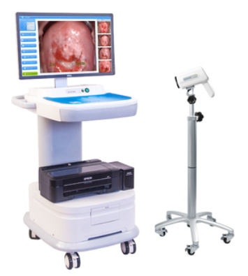 Goldcare GC-8000E Full HD Digital Video Colposcope