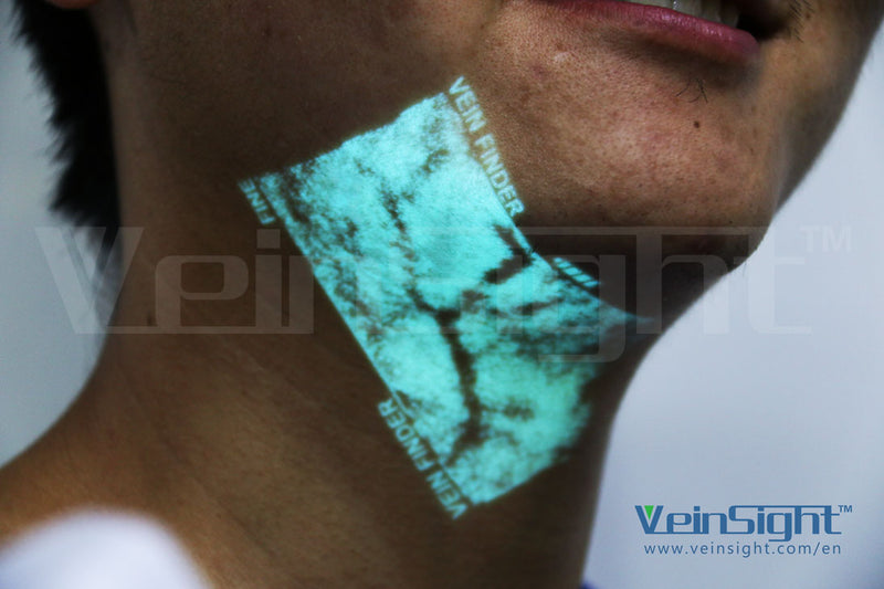 veinsight-vein-finder-face